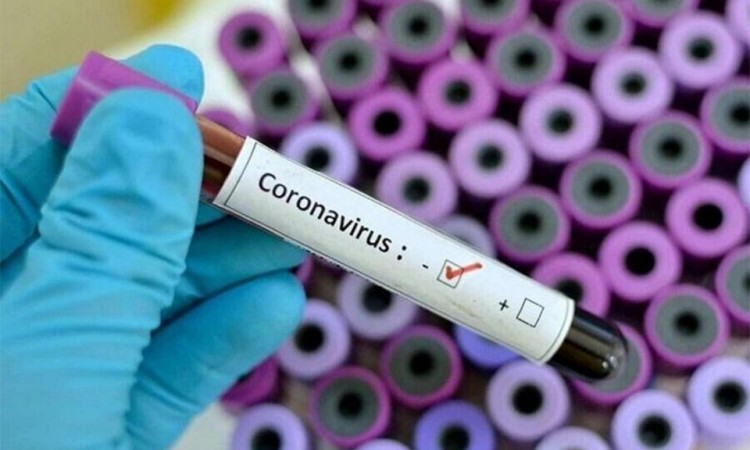 covid test